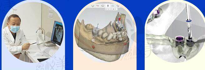 武海波医生种植牙技术怎么样