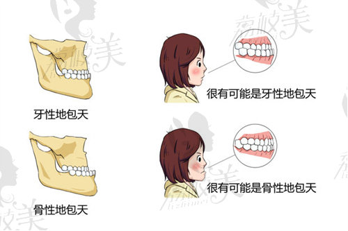 廣州侯振杰正頜多少錢(qián)