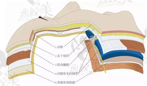 成都蒲興旺能做五層提升術(shù)嗎