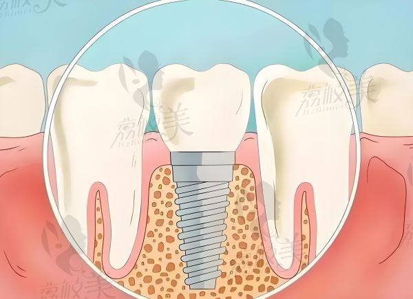 淮安牙知道口腔种植医生推荐