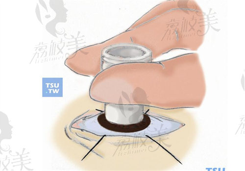 普瑞眼科属于中高端档次