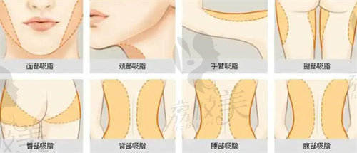 淄博天麗整形吸脂價格