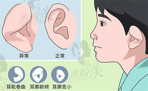 章庆国耳再造排名第几