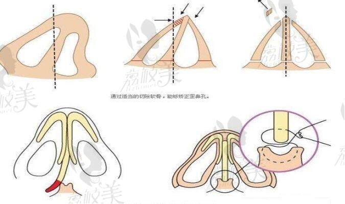 吳玉家醫(yī)生在北京米蘭柏羽麗都整形醫(yī)院有出診