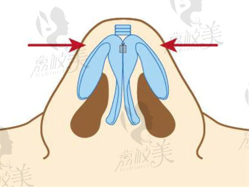 刘魏做鼻子技术好吗