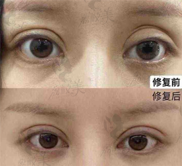 成都虞冬梅医生个人简介