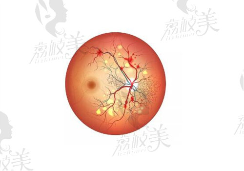 石家庄爱眼眼科医院宋桂莲医生经验多