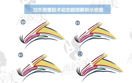 劉志剛眼修復(fù)有沒(méi)有失敗范例？