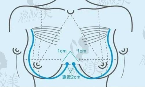 武汉隆胸徐国建是博士吗？