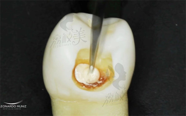 泰州玲瓏口腔門診部怎么樣 泰州玲瓏口腔門診部怎么樣
