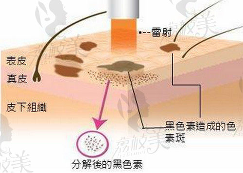 武汉艺星朱姝医生患者口碑不错