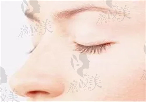 韩国丽延长整形医院鼻子