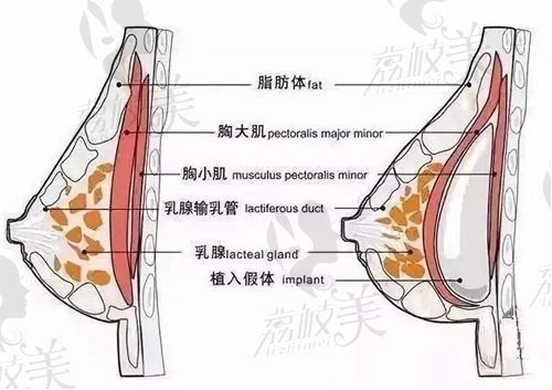 武汉艺星徐国建做胸怎么样？