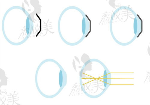 梦戴维dv和ap的区别在于价格不同