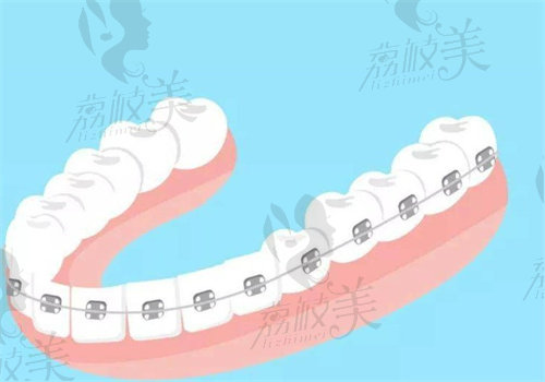 呼和浩特牙齿矫正医院哪家好