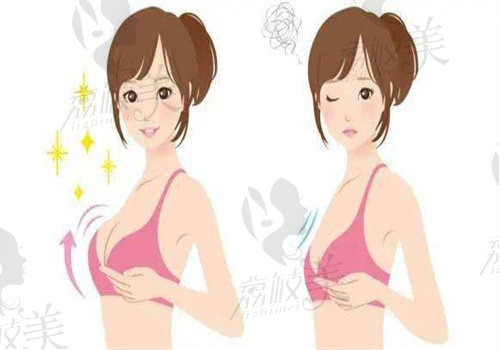 成都刘亚平医生垂乳悬吊价格：3万元-5万元起.jpg