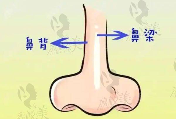 牛永敢修复鼻子口碑好