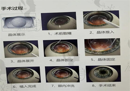 爱尔眼科医院可以微信支付