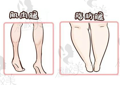 李沁奕腿部矯正手術