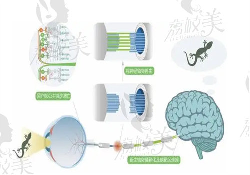 視神經(jīng)再生未來展望