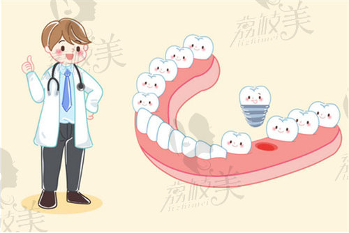 种植牙成本多少钱一颗