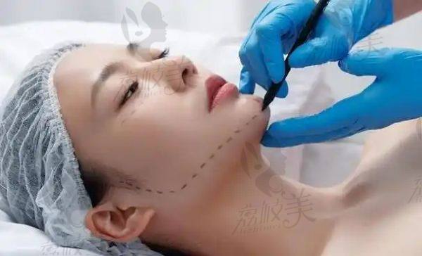 天津做筋膜提升好的医院在哪