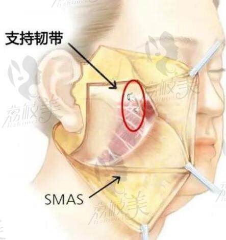 北京柳民熙拉皮小切口獨(dú)具優(yōu)勢-點(diǎn)正文看柳民熙整形醫(yī)術(shù)到底怎么樣