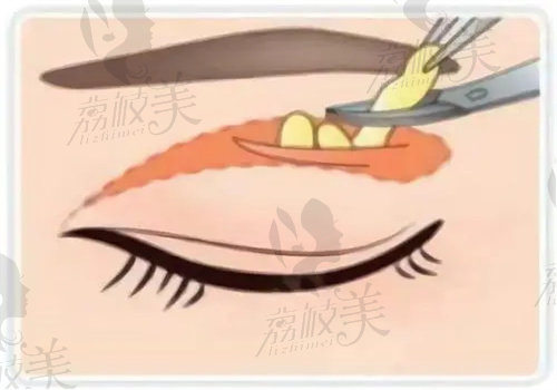 拉萨爱思特医疗美容靠谱吗.jpg