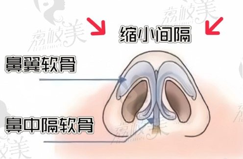 上海時(shí)光徐懷河做鼻子怎么樣？