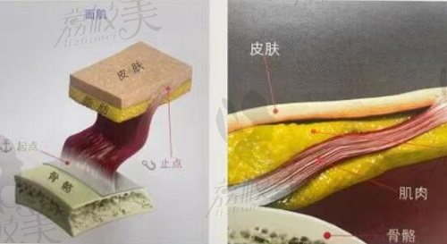 注射溶解酶修复馒化脸
