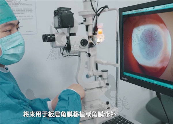 爱尔眼科做角膜移植多少钱