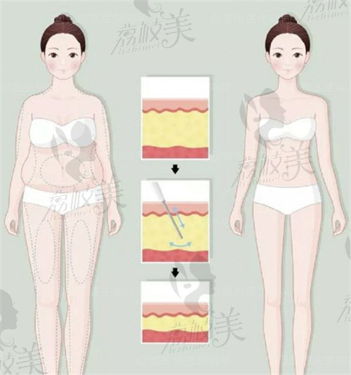 厦门整形美容价格表