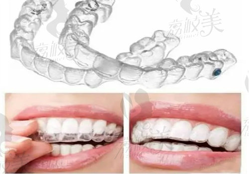 寧波牙博士口腔牙齒矯正怎么樣