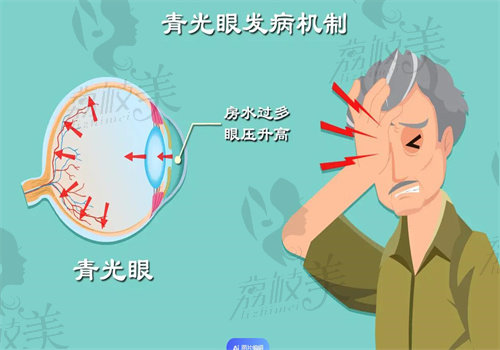 阳泉眼科医院青光眼手术价格