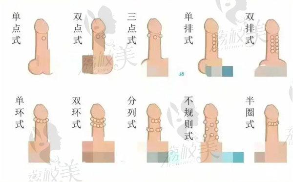 男士鑲珠手術(shù)在哪兒做