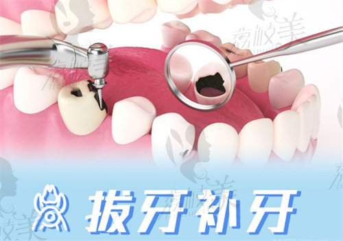 赤峰牙科收費價目表