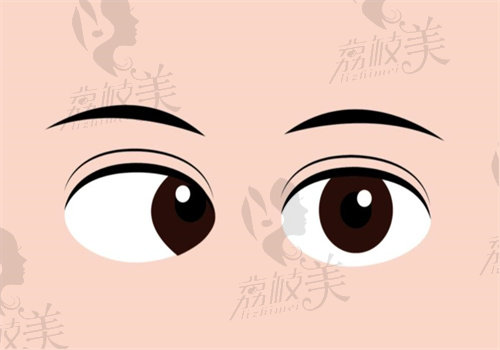 爱尔眼科眼底病手术哪个医生好