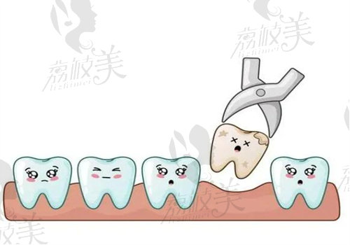 成都拔牙哪个医院好
