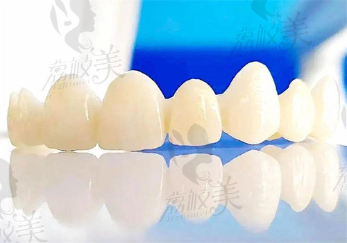 拉瓦牙冠屬于什么檔次