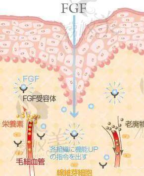 北京周云超面部異物取出做的怎么樣