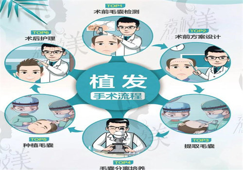 斑秃CGF治疗一个疗程就可长头发