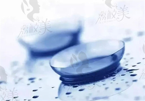 尼康控优点镜片不同度数价格