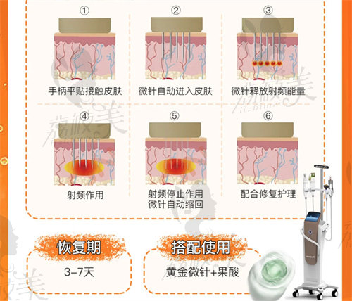 半岛逆时针是干啥的