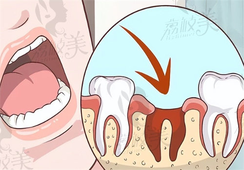 華 西口腔拔牙收費(fèi)標(biāo)準(zhǔn)