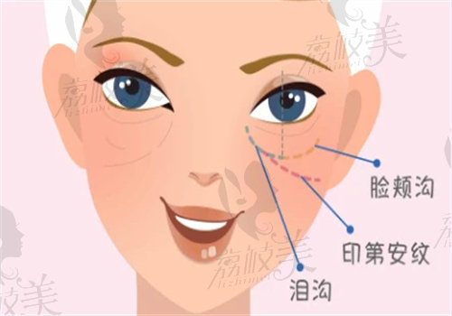 北京紫洁张学艳去眼袋技术真不错