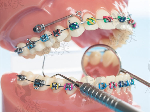 連云港中新口腔醫(yī)院牙齒正畸怎么樣