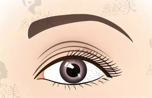 沈阳董红星做双眼皮怎么样