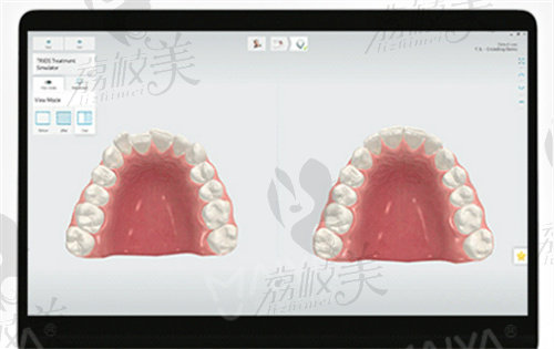 麥芽口腔種植牙齒技術(shù)行不行