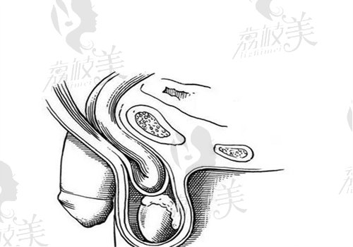 2025年国内热门医院男士入珠手术推荐 2025年国内热门医院男士入珠手术推荐