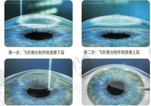 石河子市妇幼 保健院眼科做青光眼很在行